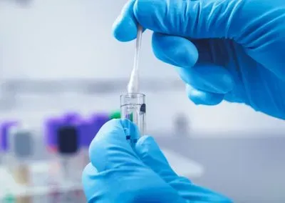 COVID-19, SARS-CoV-2, coronavirus, pandemic, virus, B.1.1.7, B.1.525, variant, UK COVID-19, SARS-CoV-2, coronavirus, pandemic, virus, B.1.1.7, B.1.525, variant, UK